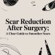 Scar Reduction After Surgery: A Clear Guide to Smoother Scars