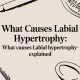 What Causes Labial Hypertrophy: what causes labial hypertrophy explained