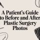 A Patient’s Guide to Before and After Plastic Surgery Photos