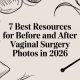 7 Best Resources for Before and After Vaginal Surgery Photos in 2026