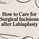 How to Care for Surgical Incisions After Labiaplasty