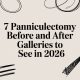 7 Panniculectomy Before and After Galleries to See in 2026