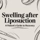Swelling After Liposuction A Patient’s Guide to Recovery