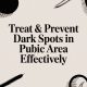 Treat & Prevent Dark Spots in Pubic Area Effectively