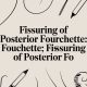 Fissuring of posterior fourchette: Fissuring of Posterior Fo