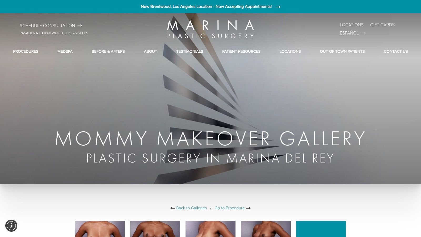 Marina Plastic Surgery (Los Angeles, CA) – Mommy Makeover Gallery