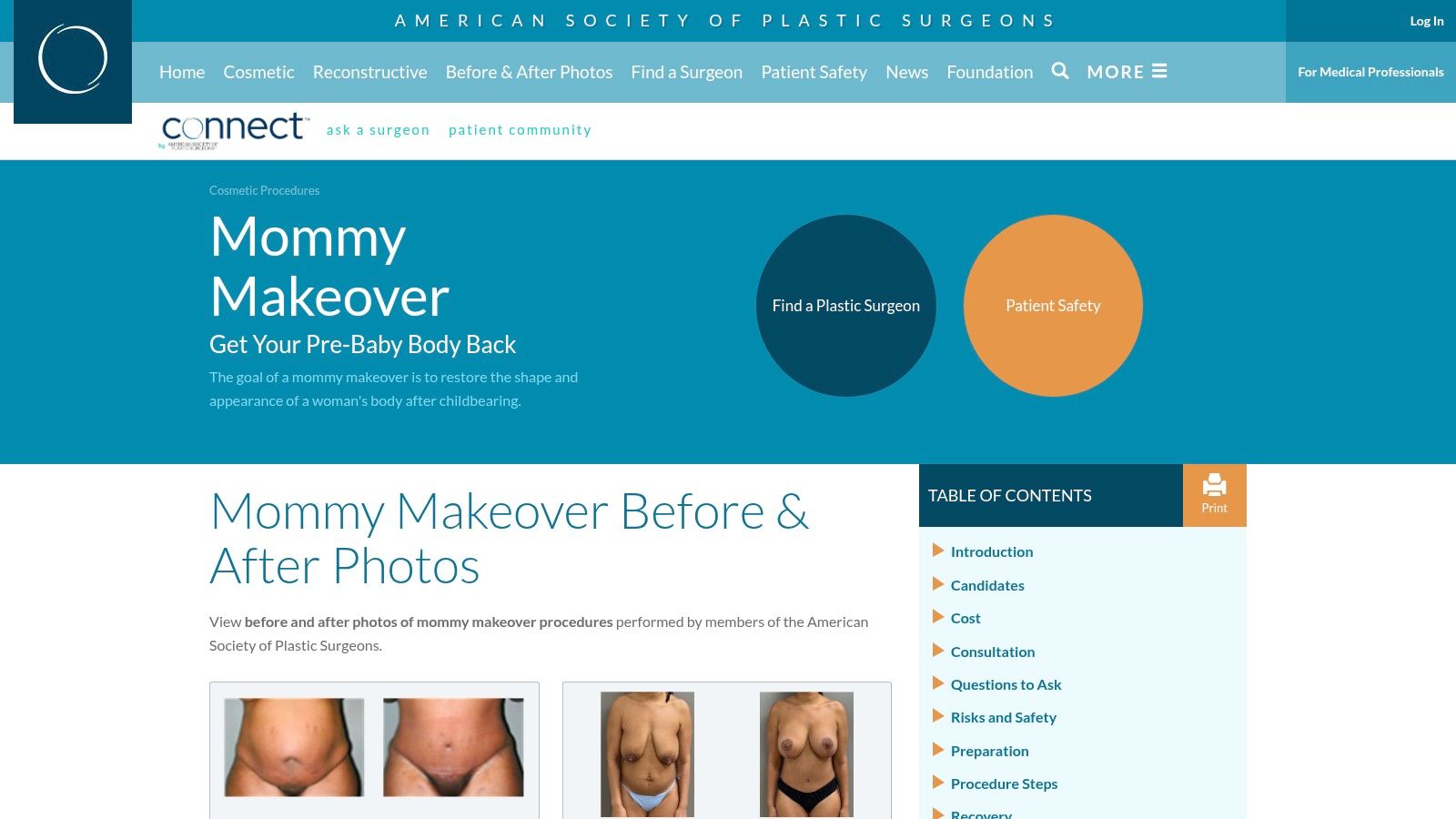 American Society of Plastic Surgeons (ASPS) – Photo Gallery