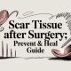 Scar Tissue After Surgery: Prevent & Heal Guide