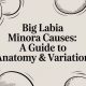 Big Labia Minora Causes: A Guide to Anatomy & Variation