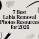 7 Best Labia Removal Photos Resources for 2026