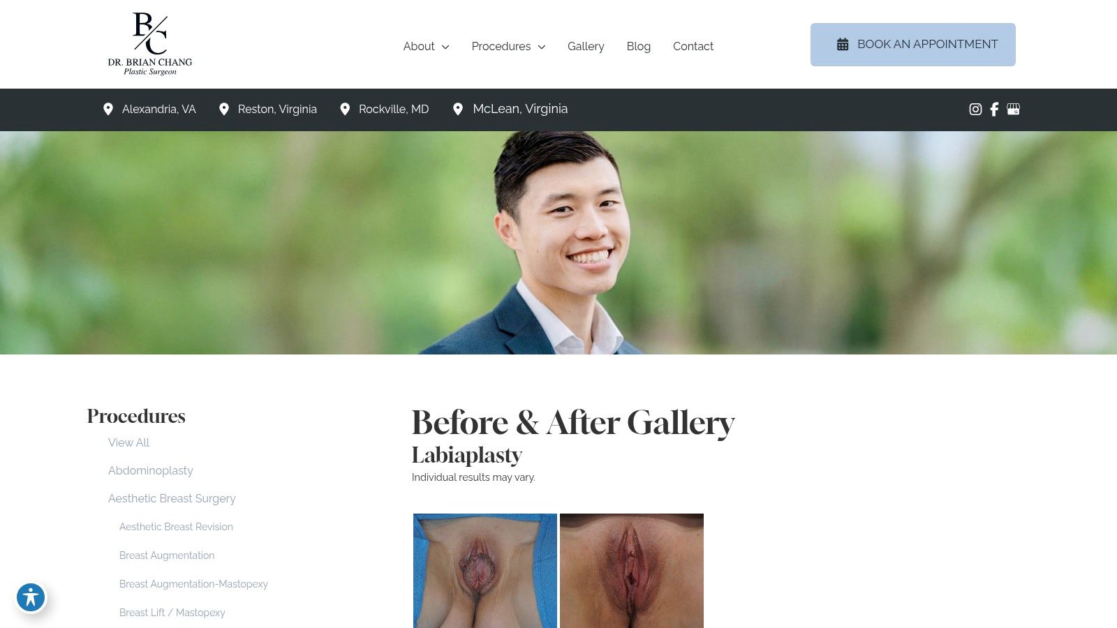 Brian Chang Plastic Surgery (Alexandria, Reston, McLean, VA; Rockville, MD)