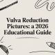 Vulva Reduction Pictures: A 2026 Educational Guide