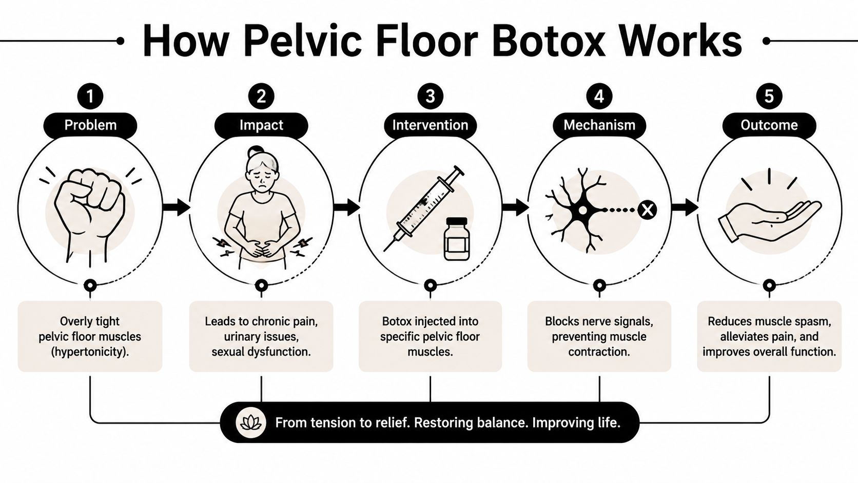 A five-step infographic showing how pelvic floor Botox treats muscle tension to alleviate chronic pain and dysfunction.