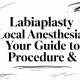 Labiaplasty Local Anesthesia: Your Guide to Procedure &