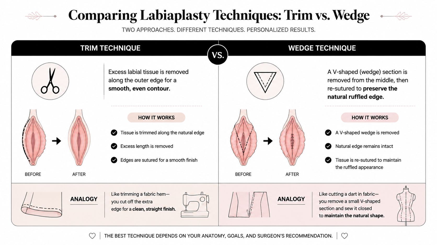 A comparison chart showing the trim versus wedge techniques for labiaplasty surgery with illustrative diagrams and descriptions.