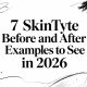 7 SkinTyte Before and After Examples to See in 2026