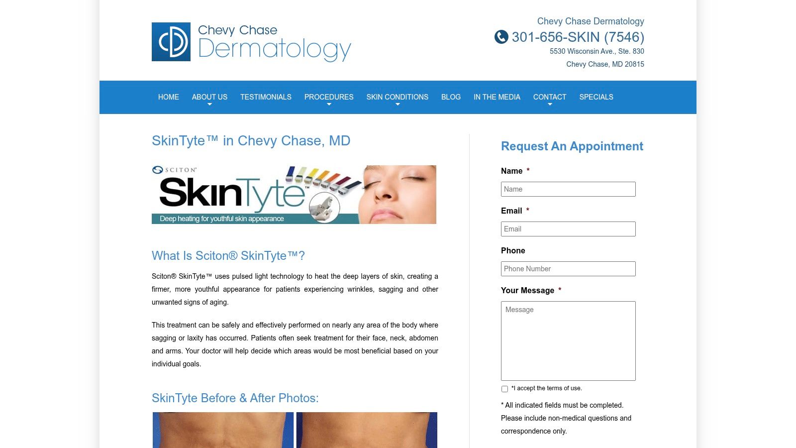 Chevy Chase Dermatology – SkinTyte overview with manufacturer handout