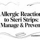 Allergic Reaction to Steri Strips: Manage & Prevent