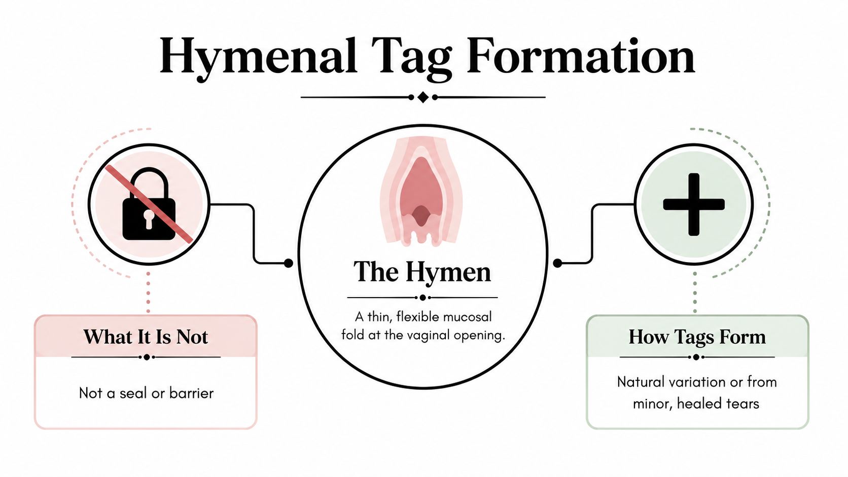 An infographic explaining that the hymen is a thin fold, not a seal, and how tags form.