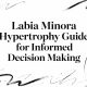 Labia Minora Hypertrophy Guide for Informed Decision Making