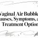 Vaginal Air Bubbles: Causes, Symptoms, and Treatment Options