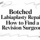 Botched Labiaplasty Repair: How to Find a Revision Surgeon