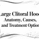 Large Clitoral Hood: Anatomy, Causes, and Treatment Options