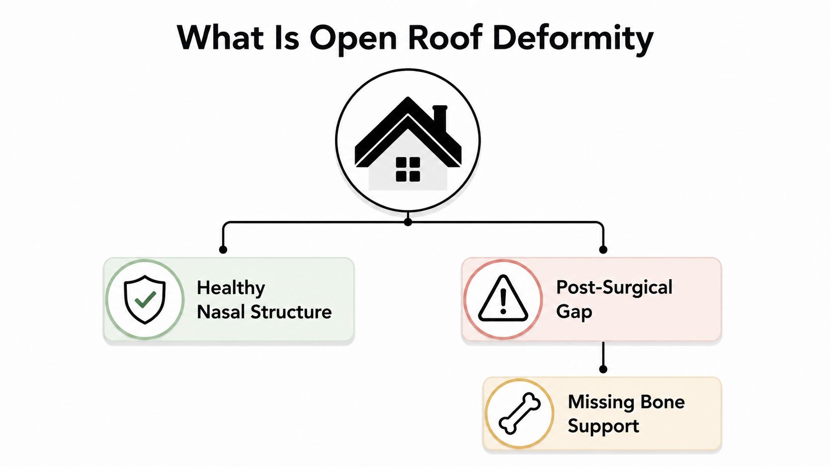 A diagram illustrating open roof deformity by comparing healthy nasal structure with post-surgical gaps and missing bone support.