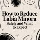 How to Reduce Labia Minora Safely and What to Expect