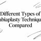 Different Types of Labiaplasty Techniques Compared