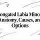 Elongated Labia Minora: Anatomy, Causes, and Options