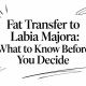 Fat Transfer to Labia Majora: What to Know Before You Decide
