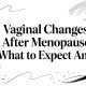 Vaginal Changes After Menopause: What to Expect And