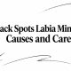 Black Spots Labia Minora: Causes and Care